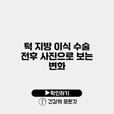 턱 지방 이식 수술 전후 사진으로 보는 변화